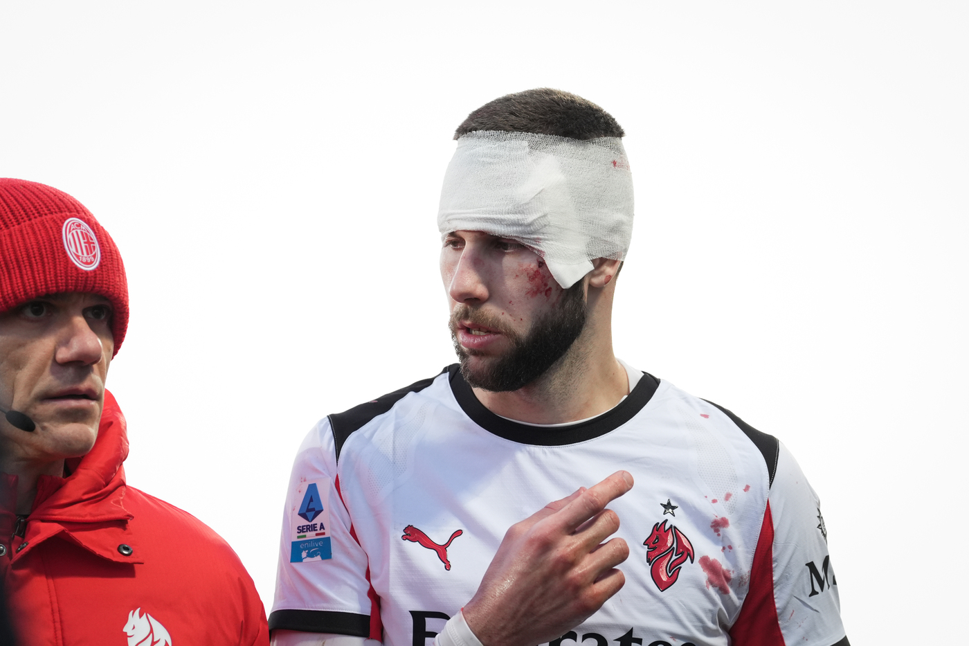 Il difensore del Milan Pavlovic con i punti di sutura alla testa lascia il campo durante Fiorentina-Milan Rossoenerisiamonoi.it